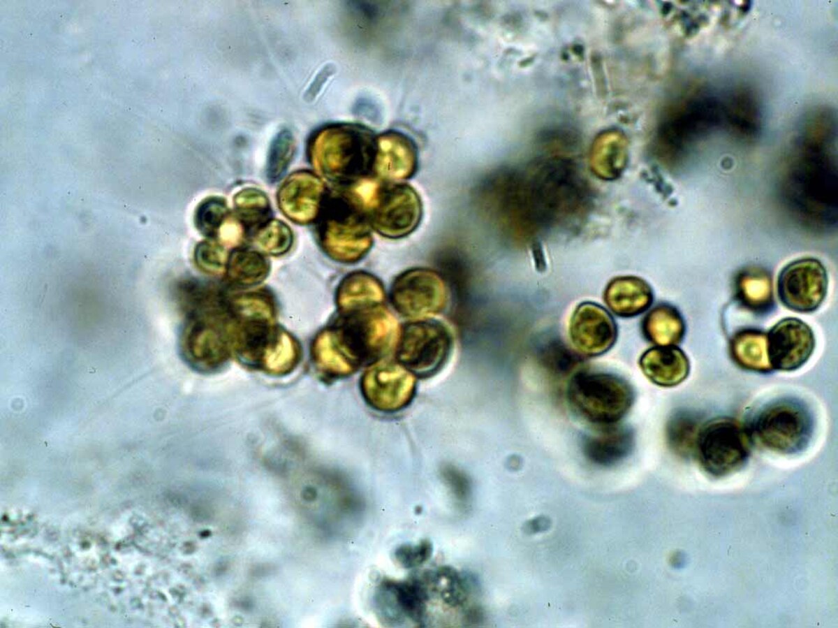 Micractinium conductrix
